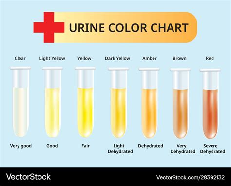 normal urine test results chart|Urine Color Chart: What’s Normal and When to See a .